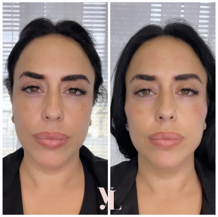 עיצוב עצמות לחיים